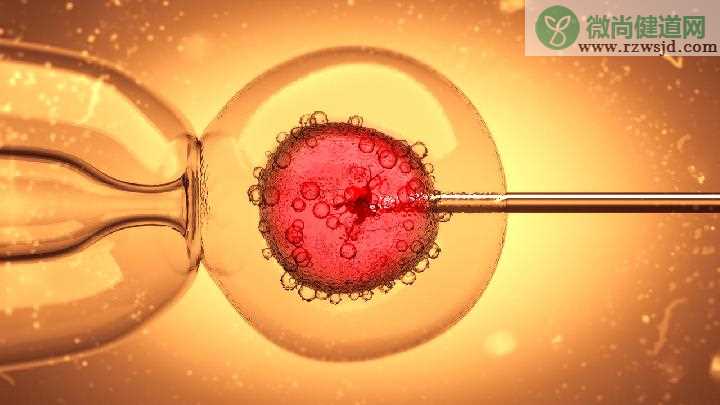 正确诊断男性前列腺钙化疾病