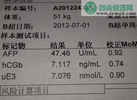 唐筛结果看男孩女孩靠谱吗 唐筛结果怎么看男女