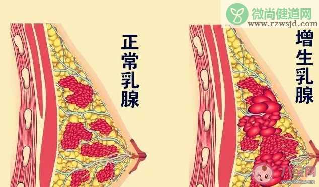 哪些行为会增加患乳腺结节的