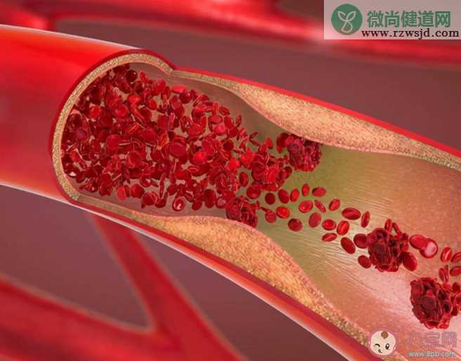 这些血管软化方法不可信 想