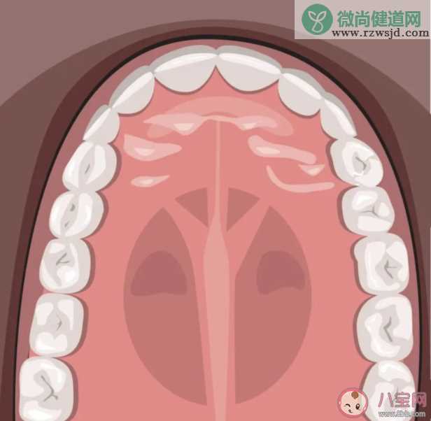 后牙槽上有黑线是什么 窝沟封闭可以预防窝沟龋坏吗