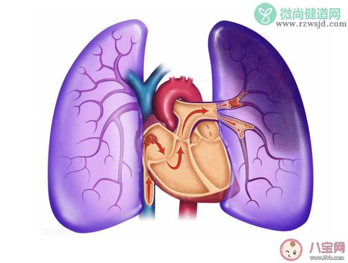 2022世界血栓日主题是什么 预防血栓做好7件小事