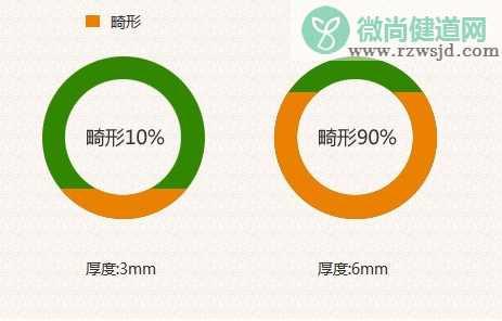 NT检查不过关怎么办 影响NT检查的结果的因素