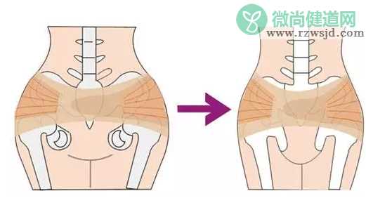 产后盆骨带有用吗 盆骨矫正带作用介绍