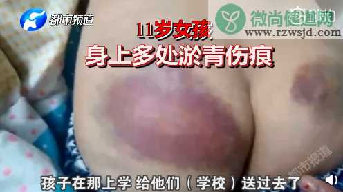 怀孕教师殴打女童是怎么回事 怀孕教师为什么殴打11岁女童