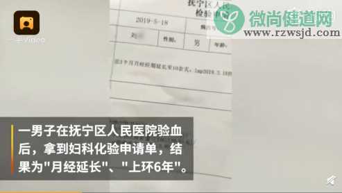 给男人开妇科化验单验出月经推迟 男人验出月经推迟