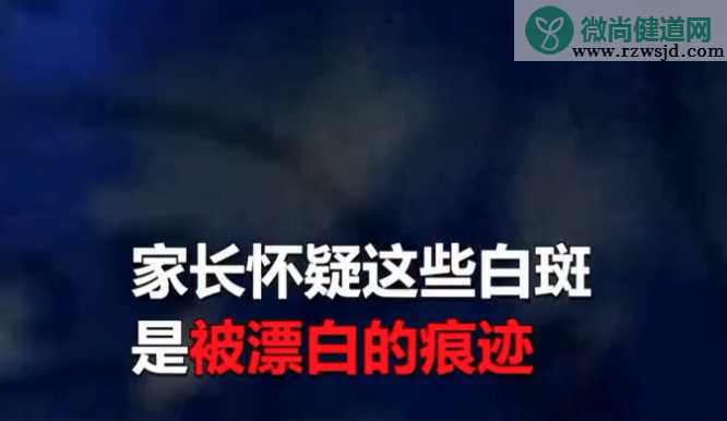 幼儿园用消毒水给孩子泡手 用消毒水给孩子泡手的是哪家幼儿园