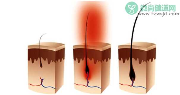 毛囊闭合还可以长出头发吗 判断毛囊健康的方法