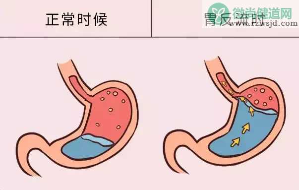 饭后返食物是怎么回事 饭后返食这是为什么2020