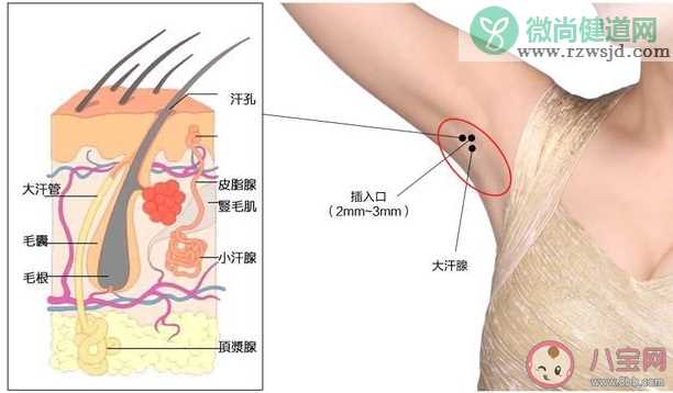 腋臭和狐臭有什么区别 腋臭和狐臭是一样的吗