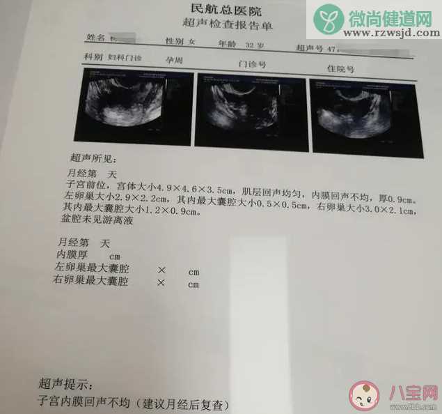 B超结果子宫内膜回声不均是