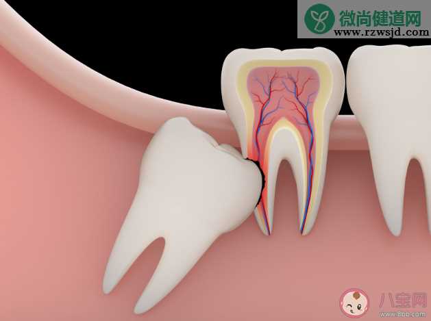 智齿每个人都会长吗 智齿不痛要拔吗