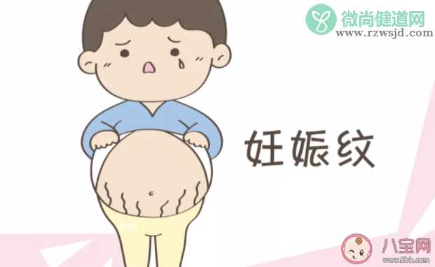 为什么妊娠纹有的孕妈没有 