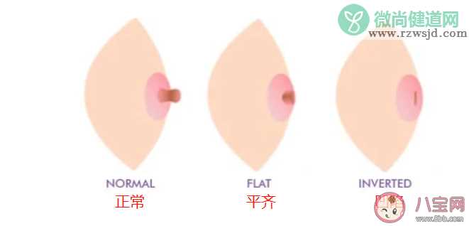 怎样的乳头算内陷 怎么判断