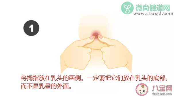 乳头内陷怎么治疗 不同程度