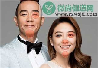 为什么很多明星有夫妻相 有夫妻相是怎么来的