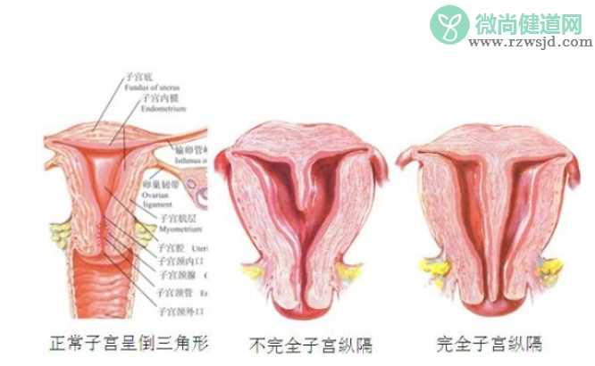 子宫纵膈有哪些临床表现 子