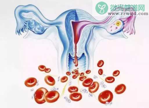 子宫内膜增厚怎么办 子宫内