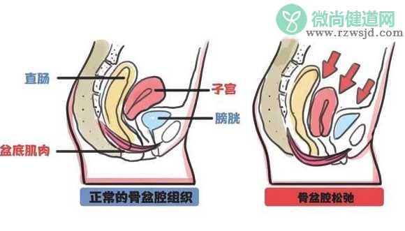 孕妇咳嗽漏尿怎么回事 孕妇咳嗽漏尿的原因