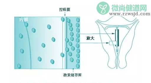 上曼月乐环不来月经正常吗 上曼月乐环月经量减少有影响吗