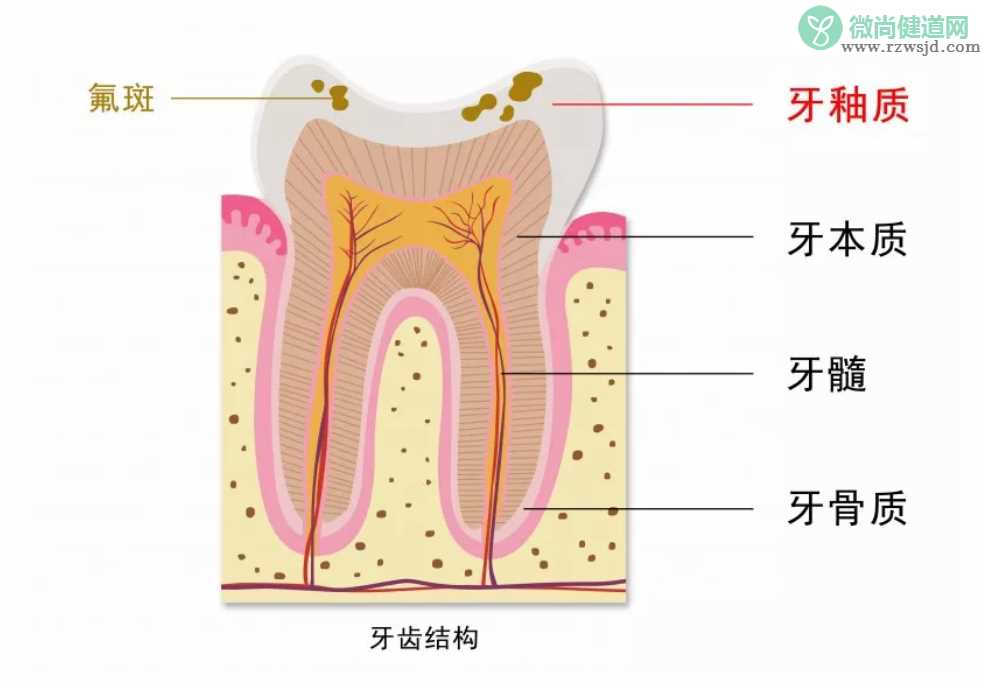 孩子用含氟牙膏会导致氟斑牙吗 3岁以下的孩子有必要用含氟牙膏吗