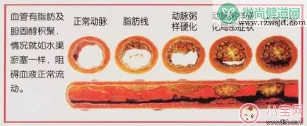 妈妈陪孩子写作业担心心梗怎