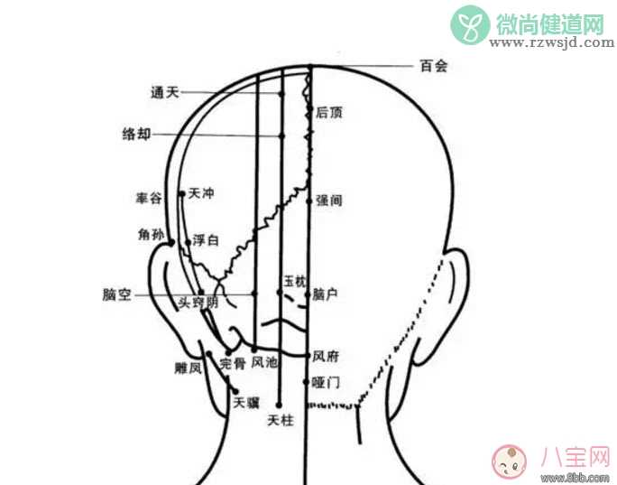 产后头疼是怎么回事 产后头疼如何治疗方法