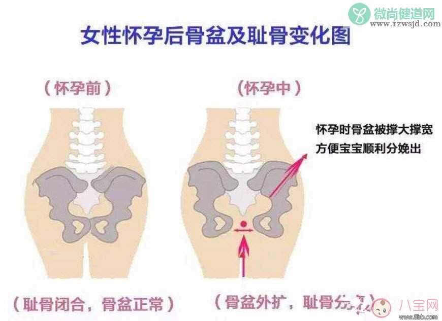 耻骨痛怎么办 孕晚期如何缓解耻骨痛