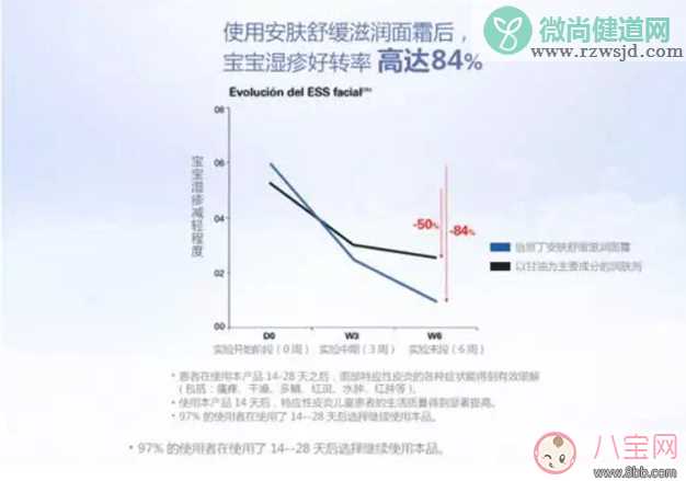 宝宝湿疹敏感肌怎么办 怡思丁婴儿湿疹面霜推荐