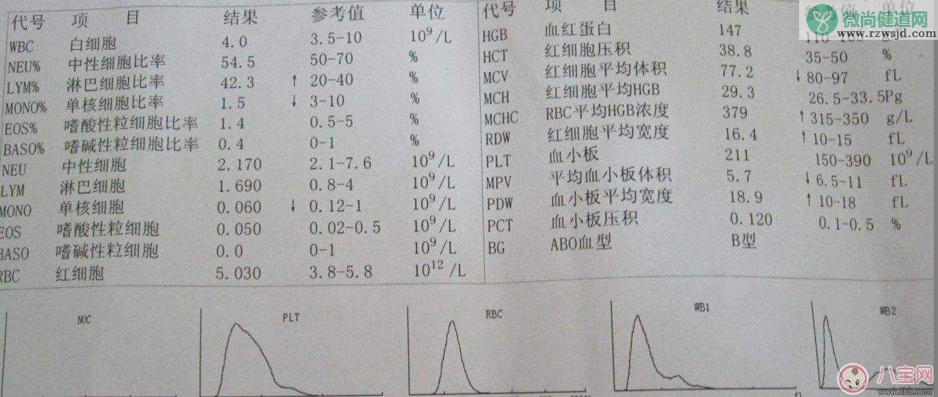 孕期血常规检查要做几次 如何看血常规报告单