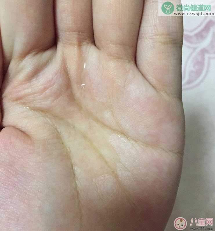 哈罗闪孕妇防妊娠纹按摩油有用吗 哈罗闪和维蕾德哪个好(孕妇分享)