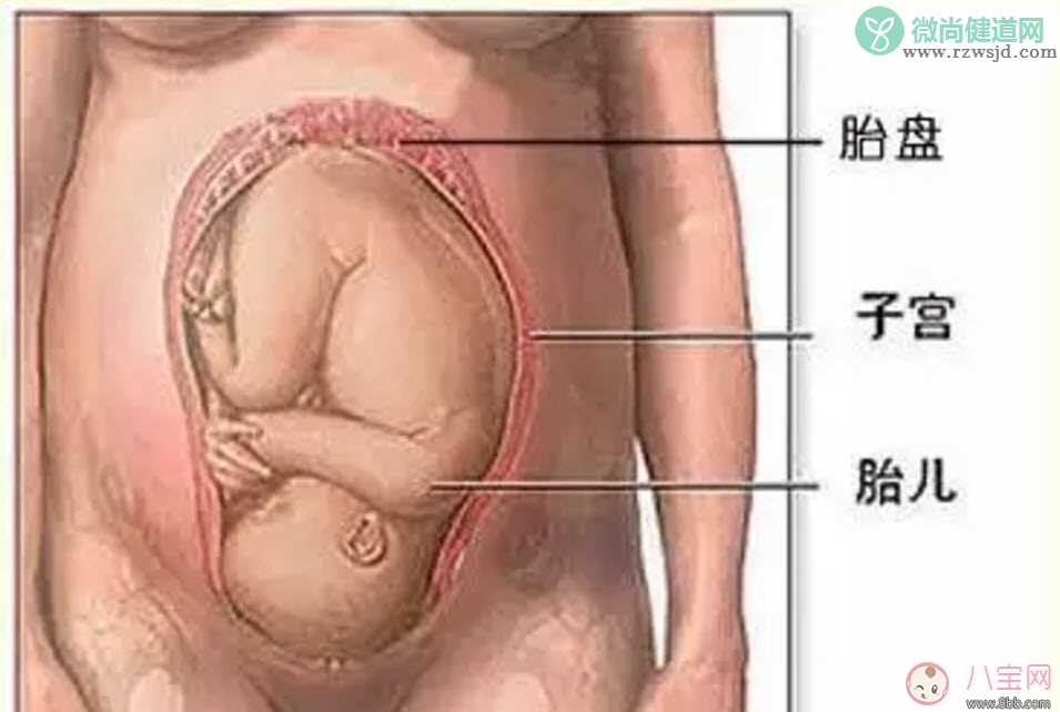 胎盘晚熟预产期会推迟吗 胎盘成熟度1级能分娩吗