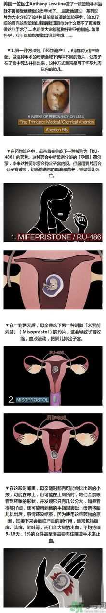 堕胎手术的可怕细节