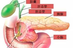 胆囊结石能用排石药吗?排出