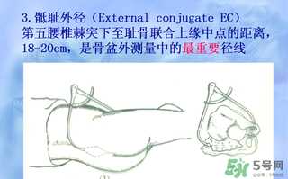 盆骨多大适合顺产 盆骨多大可以顺产