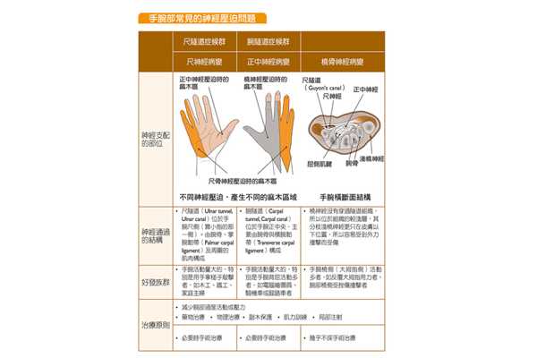 手麻每天4动作 解决神经压迫