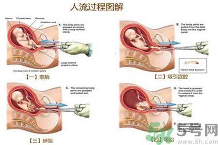 人流后怎么调养身体？人流后饮食需注意什么？