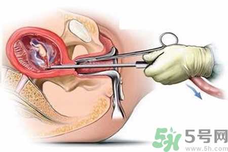 人流后怎么调养身体？人流后饮食需注意什么？