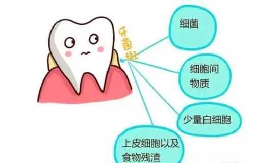 饭后多久用簌口水适合 牙结石会自己掉吗