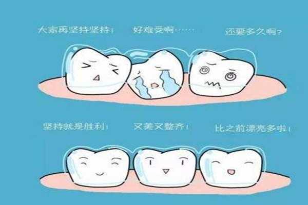 牙齿矫正会反弹吗 牙齿矫正