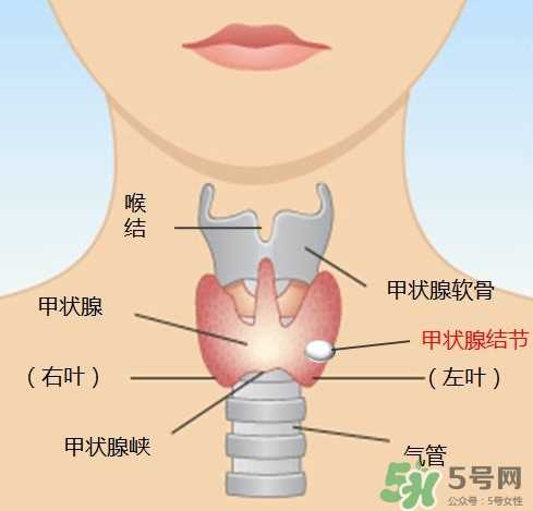 甲状腺结节如何治疗 甲状腺结节的症状