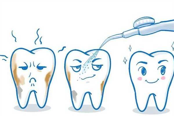 洗牙有必要洗牙根内部吗 洗牙洗的是什么