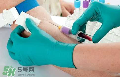 hiv阻断药哪里可以买到？艾滋病阻断药哪里有卖