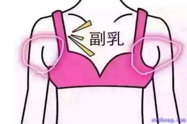 如何去副乳的方法 减掉副乳的最快方法