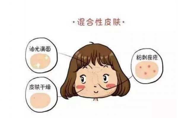 混合性皮肤是不是要多洗脸呢