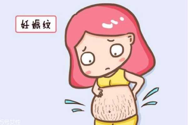 为什么有妊娠纹呢 如何去除妊娠纹呢