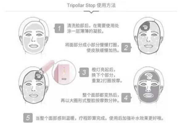 tripollar stop脖子能用吗 tripollar stop使用时需注意