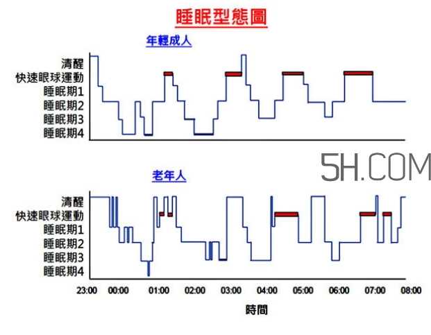 睡眠不足会促使大脑功能衰退吗?