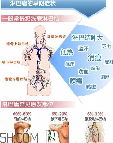 淋巴癌是怎么回事？淋巴癌如何