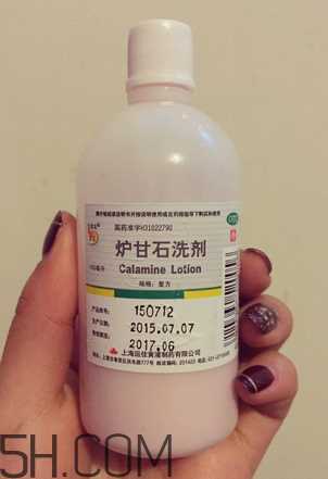 炉甘石洗剂多少钱一瓶？炉甘石洗剂治痤疮吗？